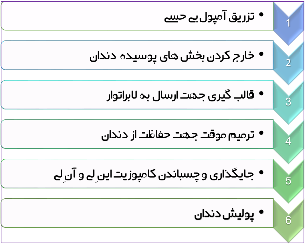 مراحل-کامپوزیت-این لی-ان لی.png