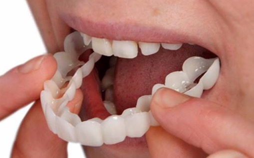 پروتز-دندان-متحرک.jpg