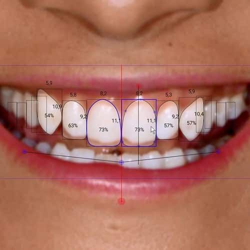 Comparison of types of removable dental prosthesis.jpg