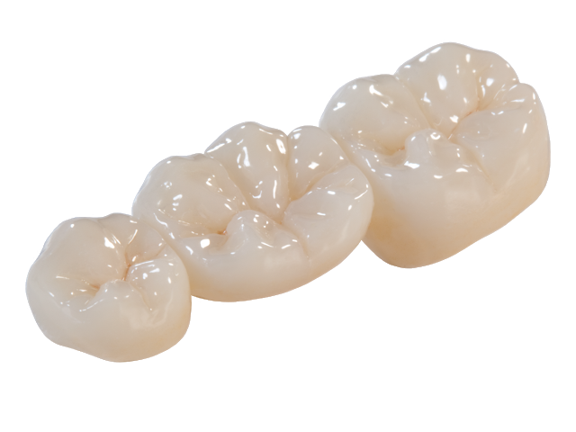 Full zirconia dental crown.jpg