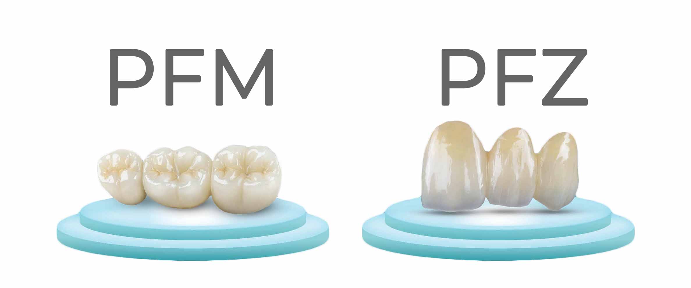 PFZ vs PFM.jpg