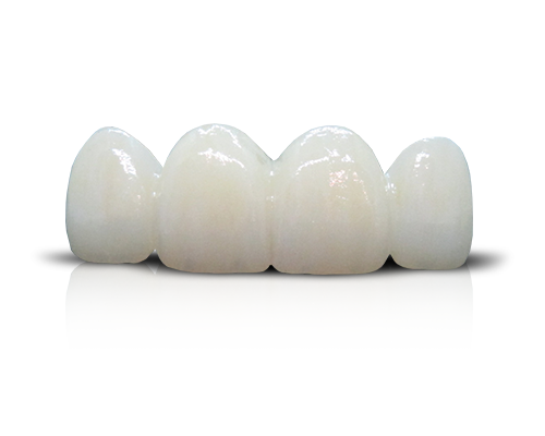 Zirconia crown (PFZ).png