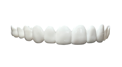 endocrown dental veneers.png