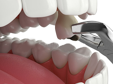3d-render-of-lower-jaw-with-tooth-stock-illustrations_csp81776257.png