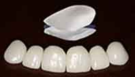 ترمیم زیبایی دندان با لامینیت یا پوشش های چینی زیبایی (Laminate)